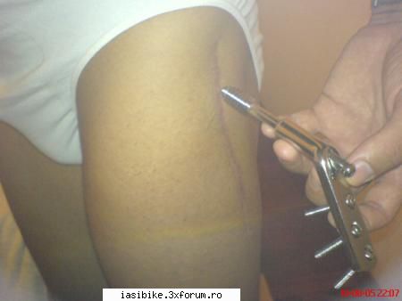 cazaturi iar asta poza cicatricea ramasa ...